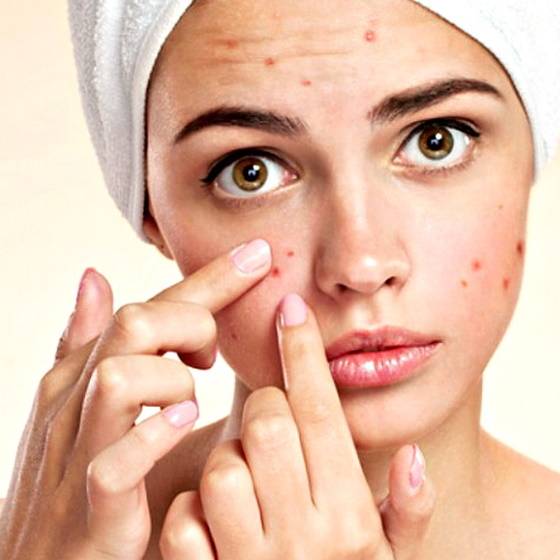 azeitonas-causam-acne